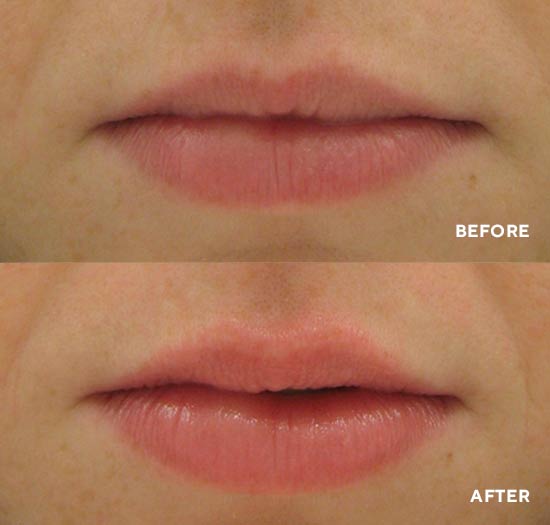 HydroPeptide Perfecting Gloss 5ml
