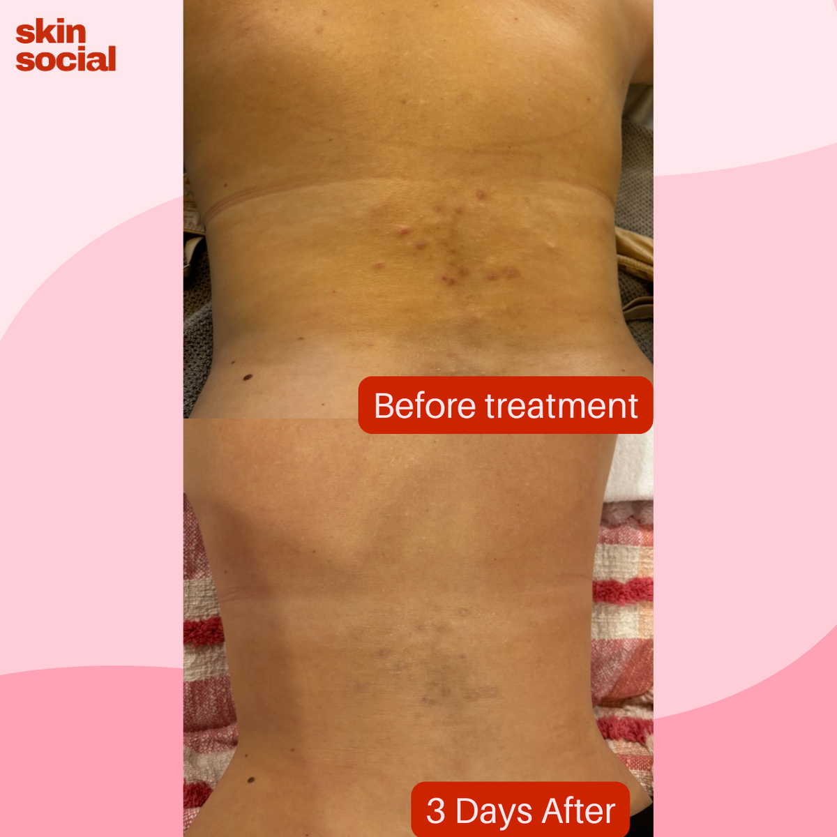 Dr Esthé Spicule K-Glow Infusion