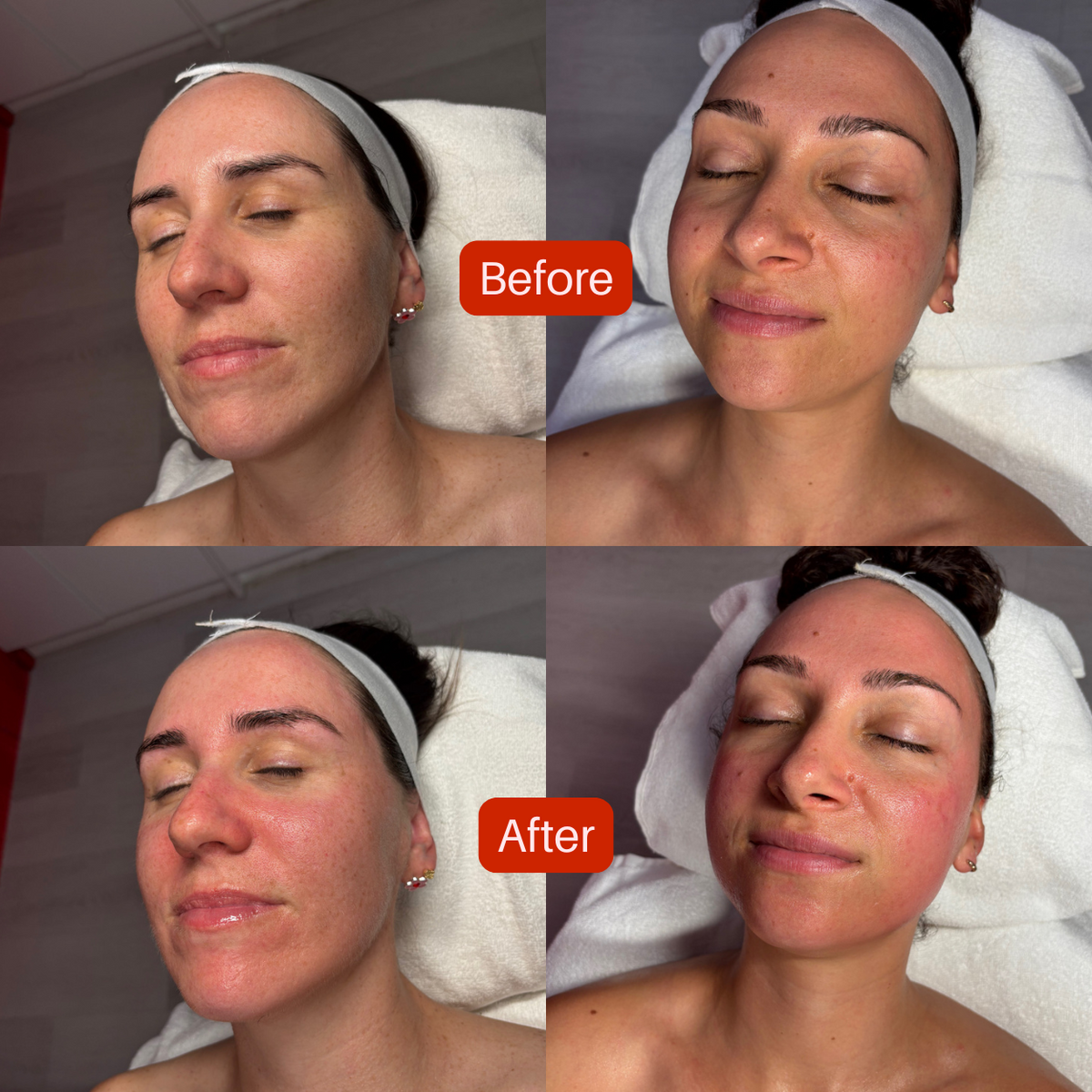 Dr Esthé Spicule K-Glow Infusion