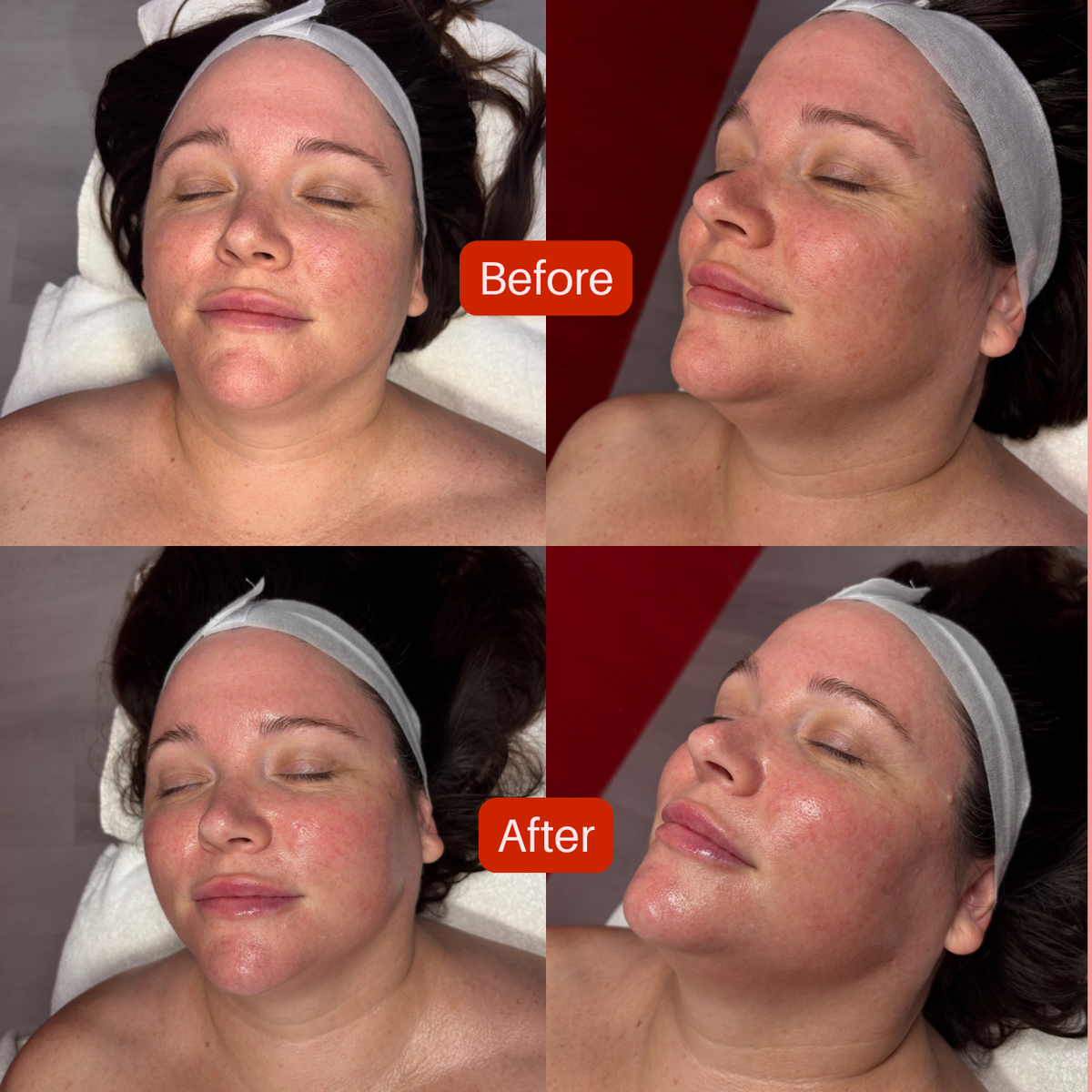 Dr Esthé Spicule K-Glow Infusion