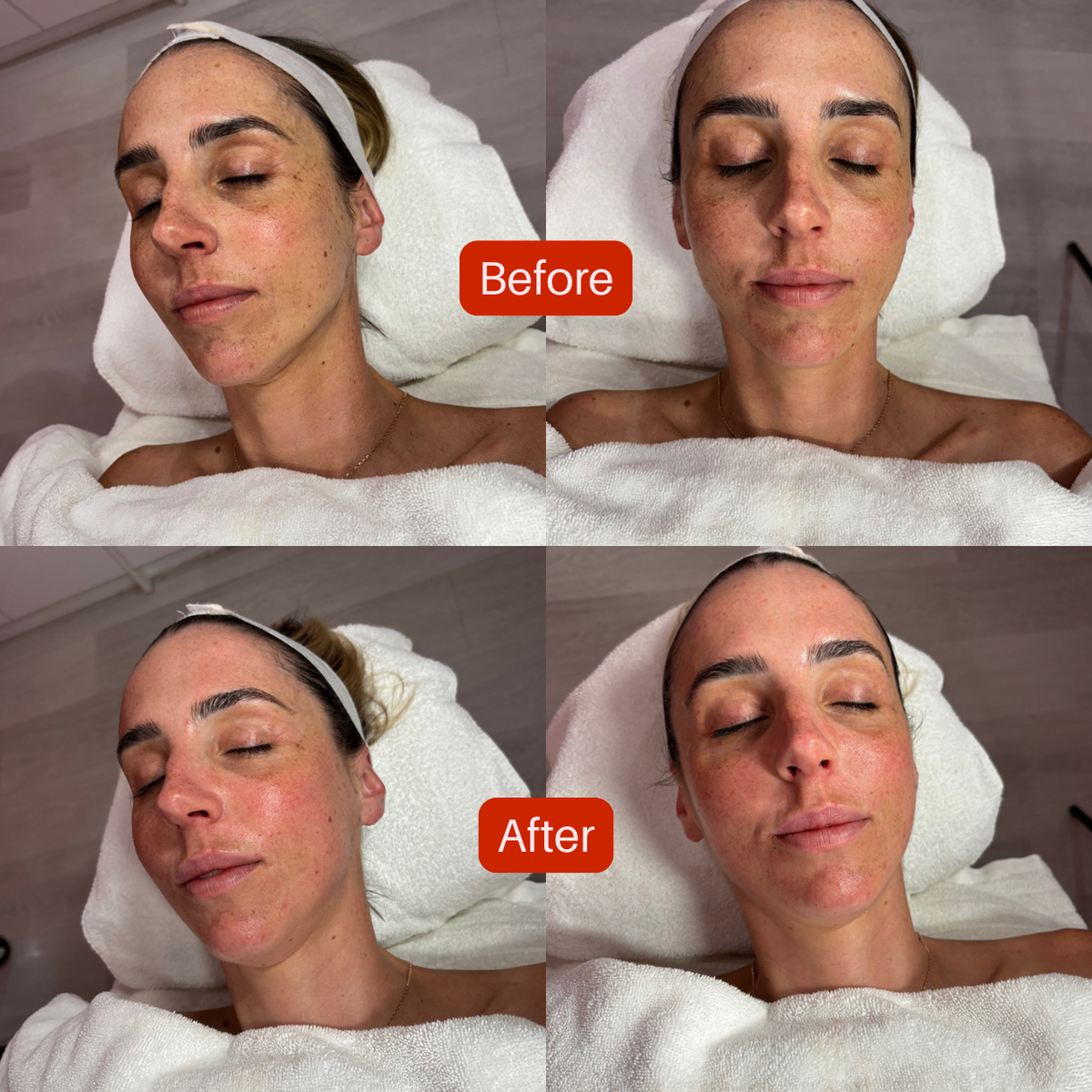 Dr Esthé Spicule K-Glow Infusion