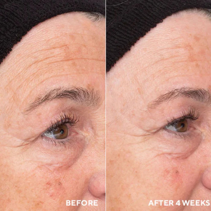 Hydropeptide Liquid Resurfacing Solution 120ml