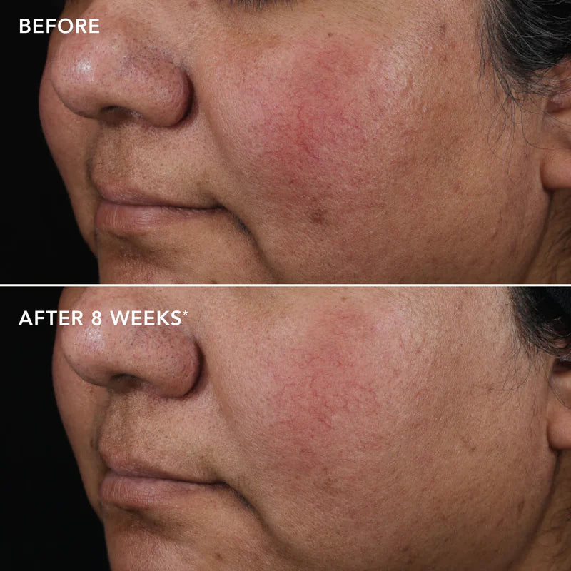 Image Ageless+ Retinol Pure Liquid Retinol 0.75% 30ml