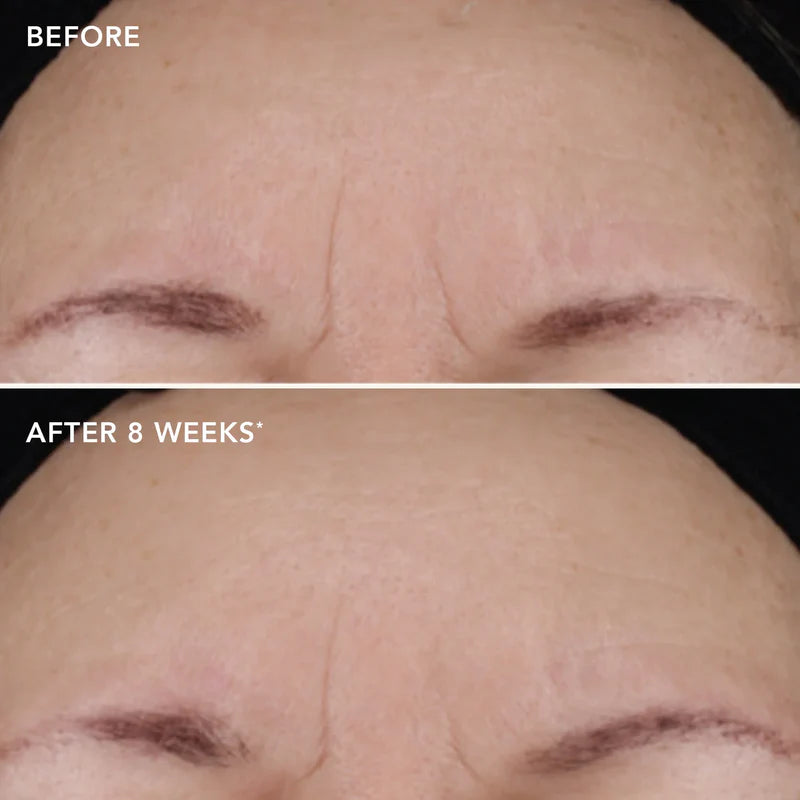 Image Ageless+ Retinol Treatment Cream 1.2% Retinol Complex 28.5g