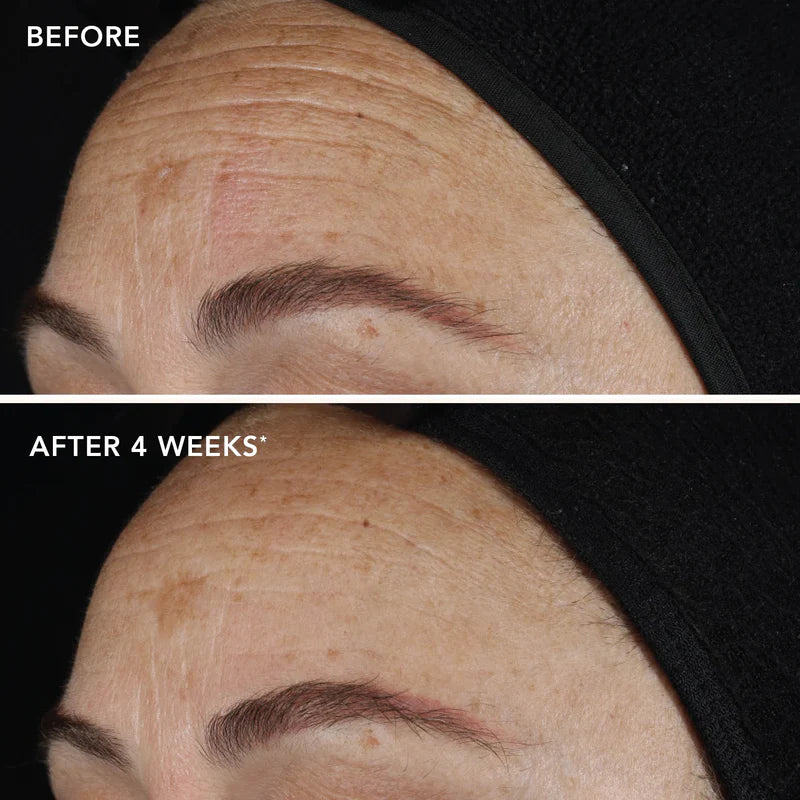 Image Ageless+ Retinol Pure Liquid Retinol 0.1% Travel Size 15ml